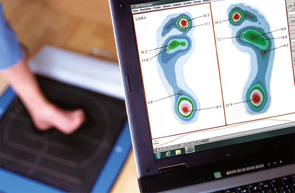 Druckmessplatte mit Fuß von Patient und Laptop mit Messergebnis Pedografie