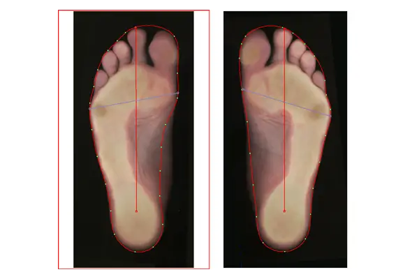 GP Fusscan S4 – 2D-Messergebnis