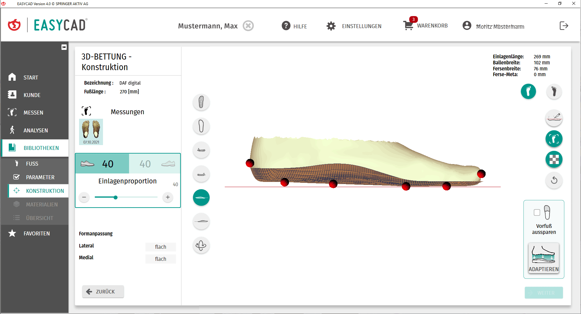 Screenshot EASYCAD Bibliothek 3D-Bettung –Adaptieren des 3D-Scans auf Einlagenoberfläche für DAF digital
