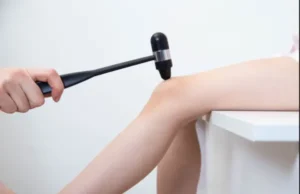Areflexie, Vollständiges Fehlen von Reflexen