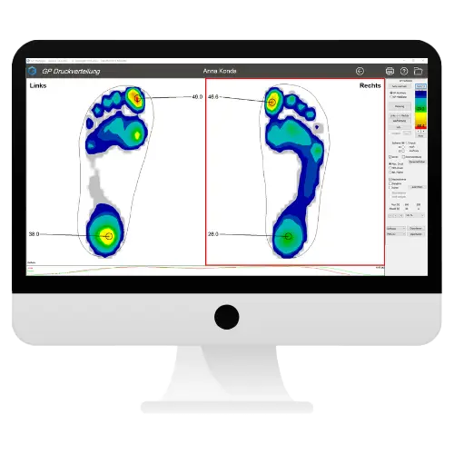 Computer mit Messergebnis Pedografie